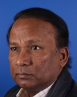 After Hair Transplant&nbsp;Front